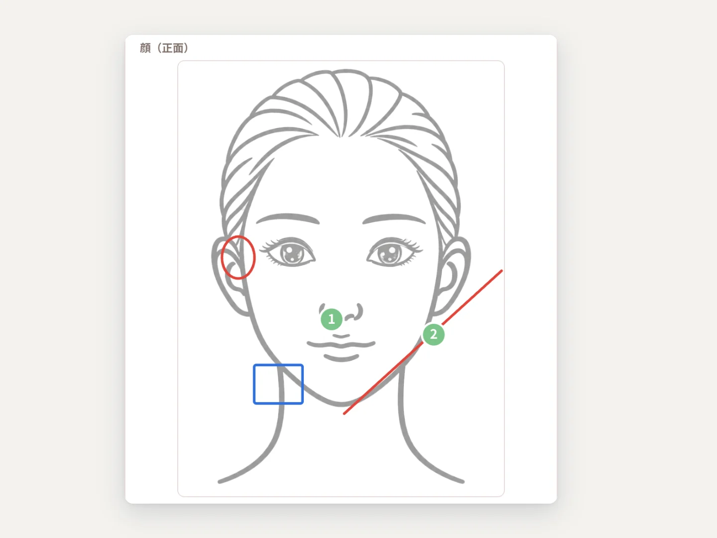 顔のイラストに丸や線、番号付きのメモを書き込んだカルテ